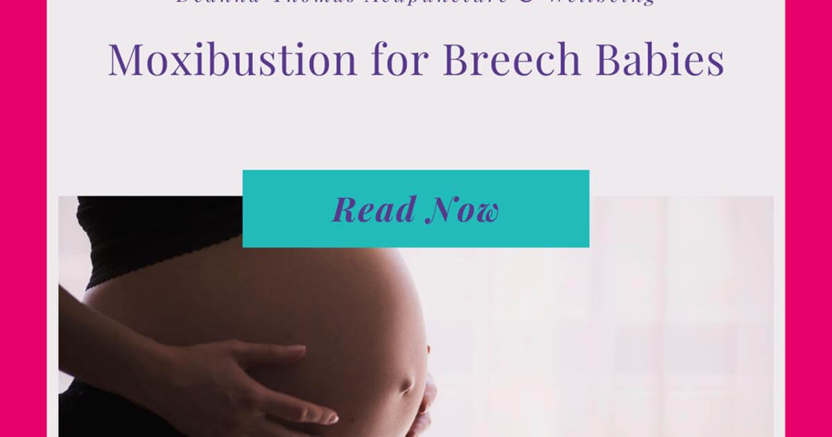 Moxibustion for Breech Babies Deanna Thomas Acupuncture & Wellbeing