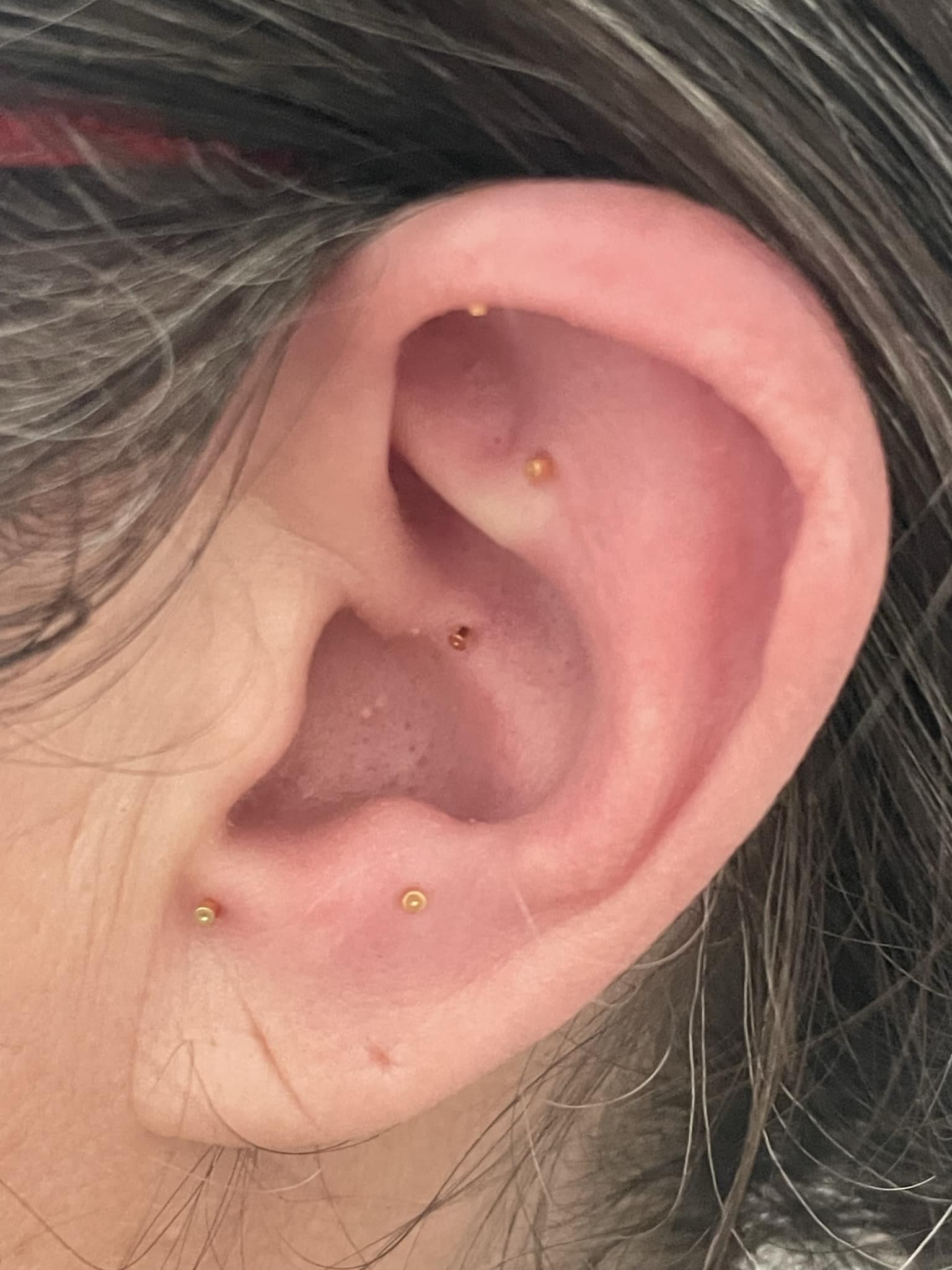 Auricular Acupuncture with Deanna Thomas Acupuncture and Wellbeing