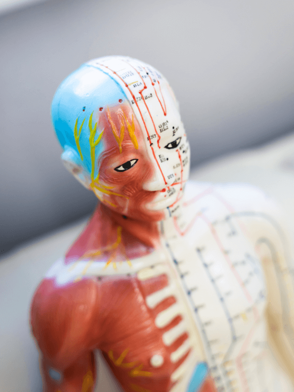 Traditional Chinese Medicine acupuncture model showing meridians and acupoints used in clinical diagnosis and treatment planning.