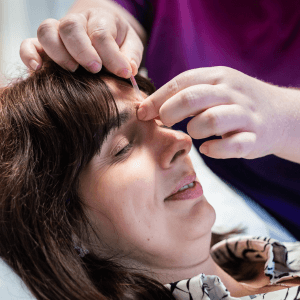 “Fertility acupuncture treatment near Darlington – licensed acupuncturist applying acupuncture points to support IVF, hormonal balance, and natural conception.”