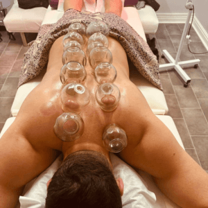 Professional cupping therapy treatment on the back to improve circulation and muscle recovery