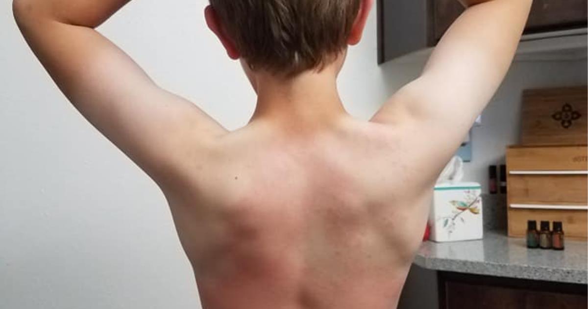 Hives! Where'd those come from?